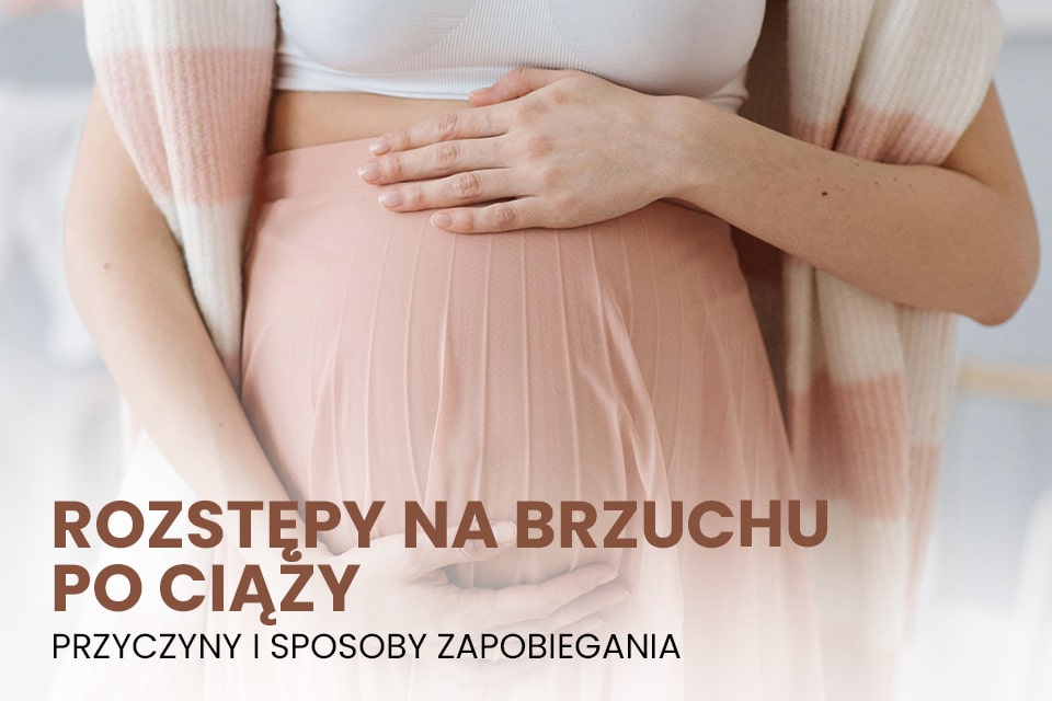 rozstępy na brzuchu po ciąży 